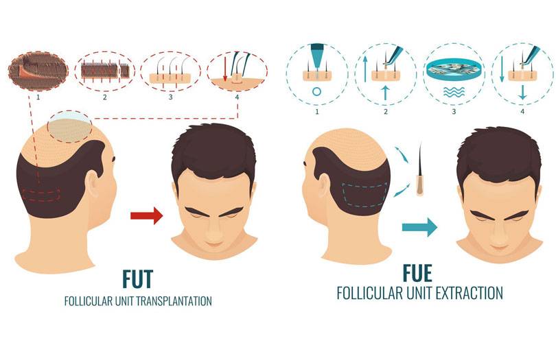 differenze-fue-fut