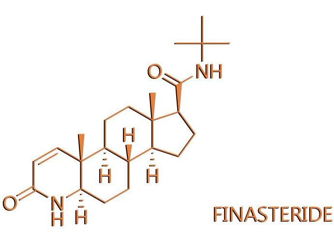 Cos’è la Finasteride e come combatte la calvizie maschile