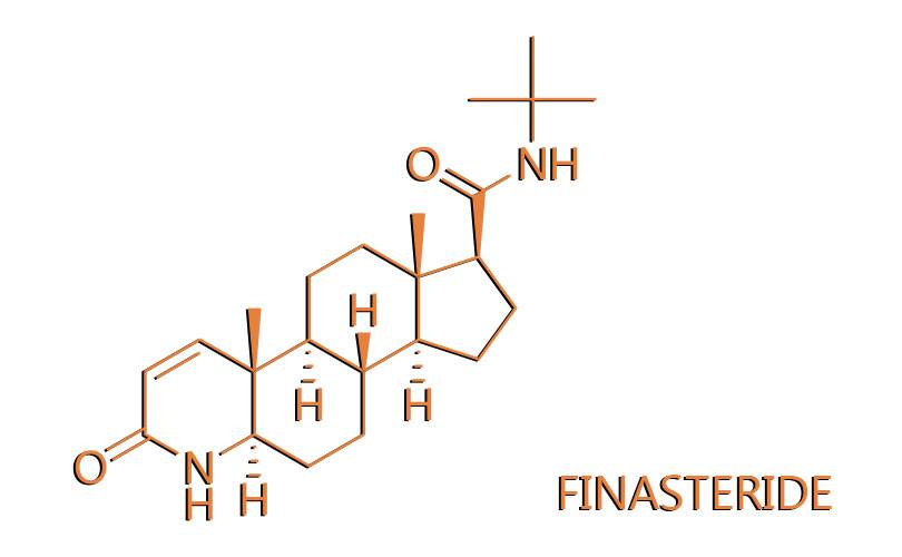 Cos’è la Finasteride e come combatte la calvizie maschile