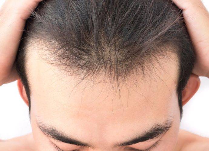 Invecchiamento dei capelli e cuoio capelluto: cause e rimedi