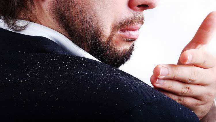 La Forfora: cos’è, cause, prevenzione e trattamenti