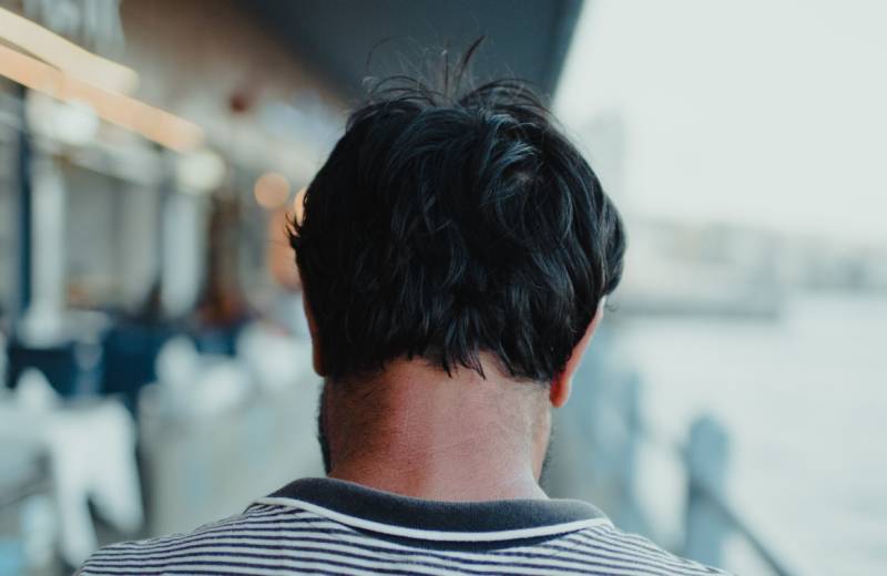 L’importanza della zona donatrice nel trapianto capelli FUE
